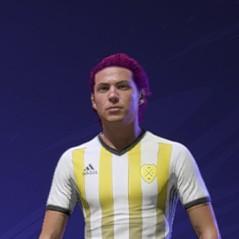 Luis xXx30