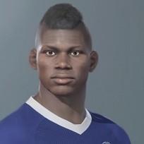 25. B. Embolo
