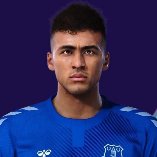 25. D. Calvert-Lewin