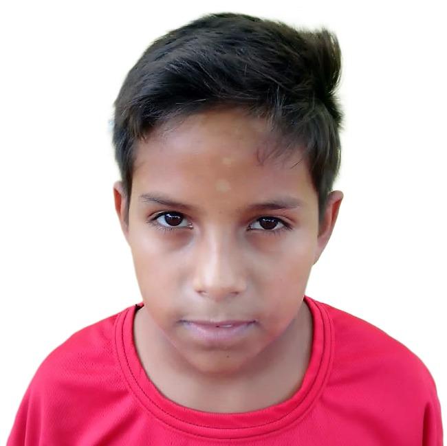 ANTHONY ALEXANDER BELLO MONTILLA