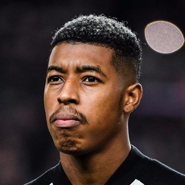 Kimpembe