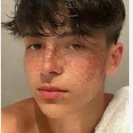 Leipzig defesa reserva