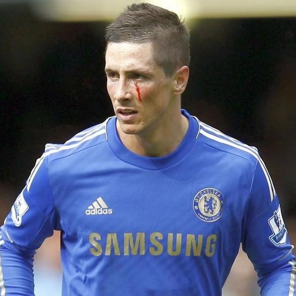 Fernando Torres