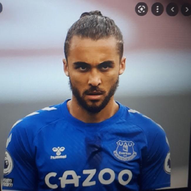 Calvert-Lewin