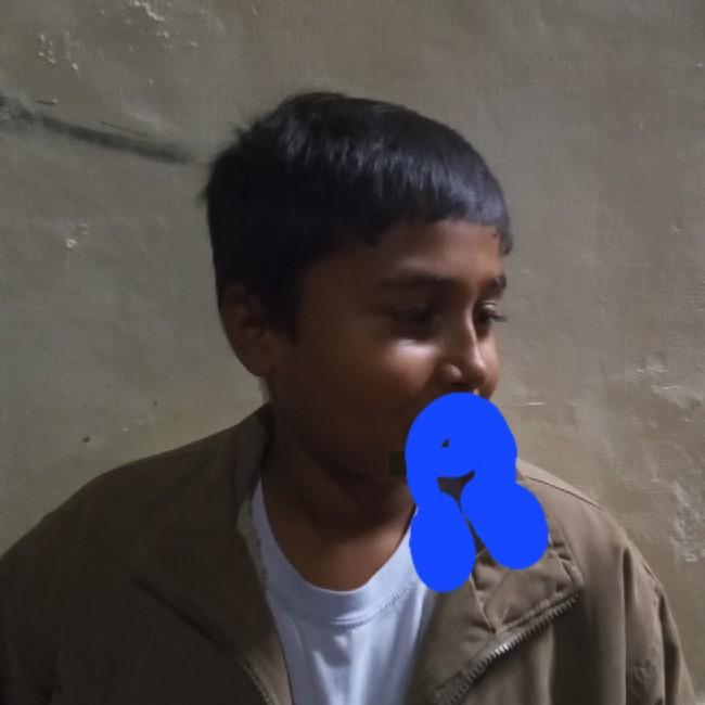 ALI