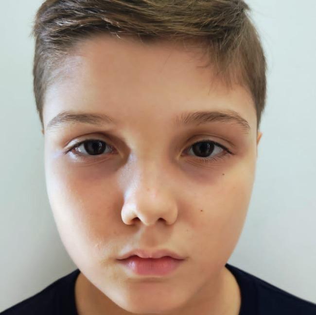 Matteo Ferrari Jönck
