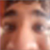 Teixeira