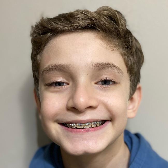 Gael Correa Celeste (UCEG)