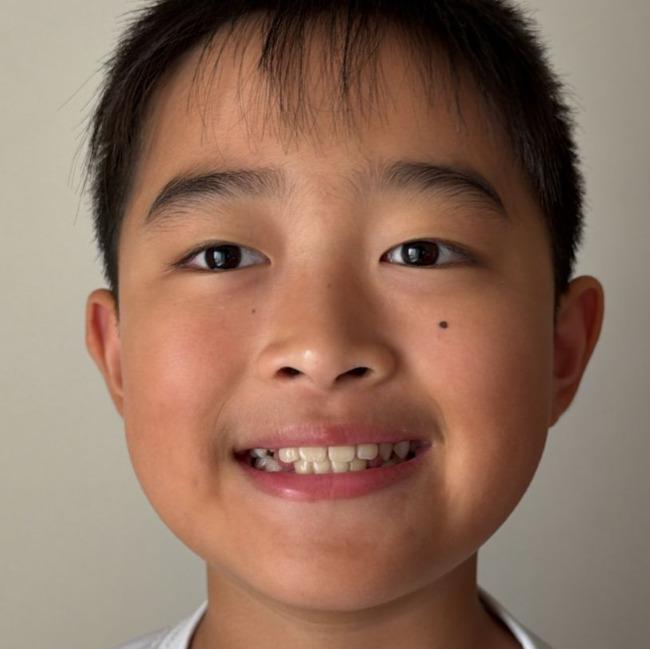 Matheus Yuto Shinohara (TTV Kochi)